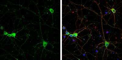 Immunocytochemistry/ Immunofluorescence: Secretagogin Antibody [NBP2-20286]