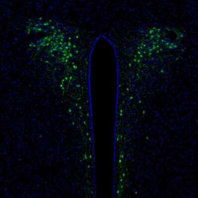 Immunohistochemistry: Secretagogin Antibody [NBP1-88219]