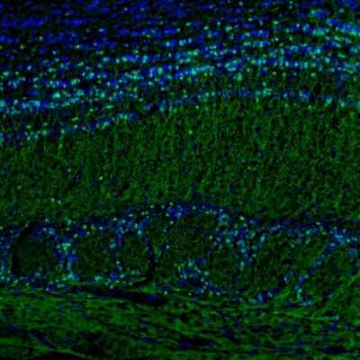 Immunohistochemistry: Secretagogin Antibody [NBP1-88219]