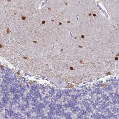 Immunohistochemistry-Paraffin: Secretagogin Antibody [NBP1-88219]