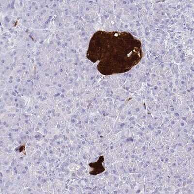 Immunohistochemistry-Paraffin: Secretagogin Antibody [NBP1-88219]