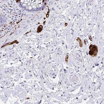 Immunohistochemistry-Paraffin: Secretagogin Antibody [NBP1-88219]