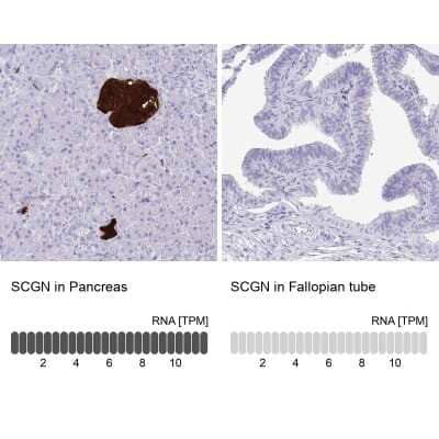 Immunohistochemistry-Paraffin: Secretagogin Antibody [NBP1-88219]