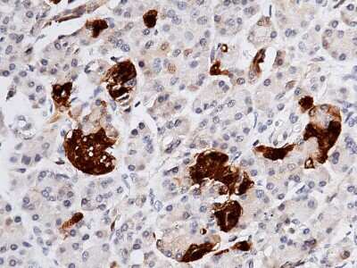 Immunohistochemistry-Paraffin: Secretagogin Antibody [NBP2-99985]