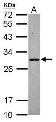 Western Blot: Secretagogin Antibody [NBP2-20286]