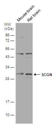 Western Blot: Secretagogin Antibody [NBP2-20286]