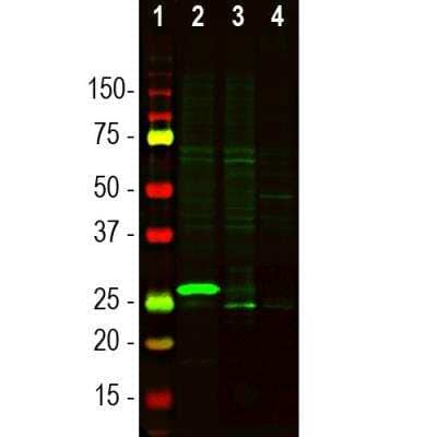 Western Blot: Secretagogin Antibody [NBP3-05545]