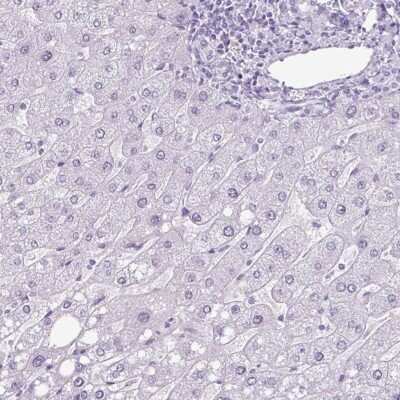 Immunohistochemistry-Paraffin: Secretin Antibody [NBP2-48988]