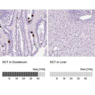 Immunohistochemistry-Paraffin: Secretin Antibody [NBP2-48988]