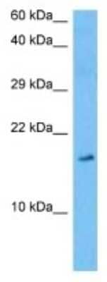 Western Blot: Secretin Antibody [NBP3-10104]