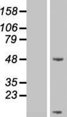 Western Blot: Secretin Overexpression Lysate [NBP2-06507]