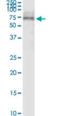 Western Blot: Secretin R Antibody (3H1) [H00006344-M01]