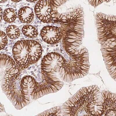 Immunohistochemistry-Paraffin: Secretin R Antibody [NBP1-86125]