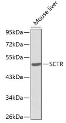 Western Blot: Secretin R AntibodyAzide and BSA Free [NBP3-03874]