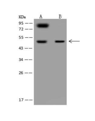 Western Blot: Secretin R Antibody [NBP3-06386]