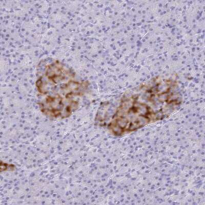 Immunohistochemistry-Paraffin: Secretogranin 3 Antibody [NBP2-49096]