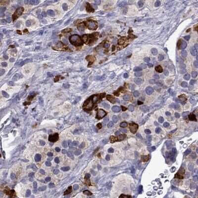 Immunohistochemistry: Secretogranin V Antibody [NBP2-68983]