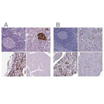 Immunohistochemistry-Paraffin: Secretogranin V Antibody [NBP1-90312]