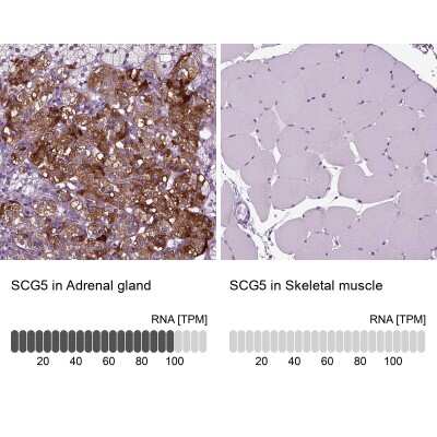 Immunohistochemistry-Paraffin: Secretogranin V Antibody [NBP1-90312]