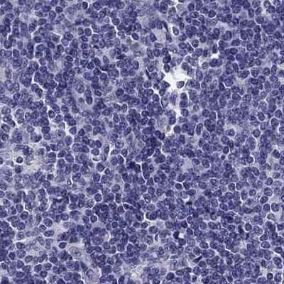 Immunohistochemistry-Paraffin: Secretogranin V Antibody [NBP2-68983]