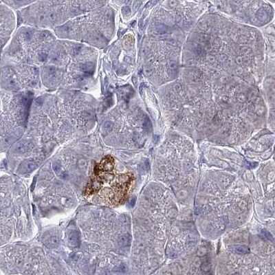 Immunohistochemistry-Paraffin: Secretogranin V Antibody [NBP2-68983]