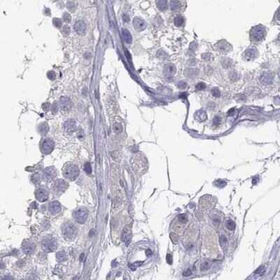 Immunohistochemistry-Paraffin: Secretogranin V Antibody [NBP2-68983]