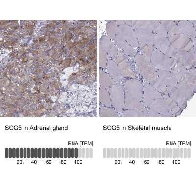 Immunohistochemistry-Paraffin: Secretogranin V Antibody [NBP2-68983]