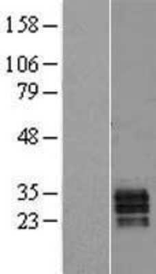 Western Blot: Secretogranin V Overexpression Lysate [NBL1-15731]