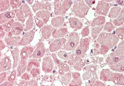 Immunohistochemistry-Paraffin: Secretory phospholipase A2 Type V Antibody [NBP2-88236]