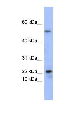 Western Blot: Secretory phospholipase A2 Type V Antibody [NBP1-57906]