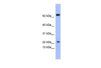 Western Blot: Secretory phospholipase A2 Type V Antibody [NBP2-88236]