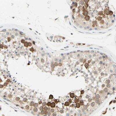 Immunohistochemistry-Paraffin: PTTG1 Antibody [NBP1-84025]