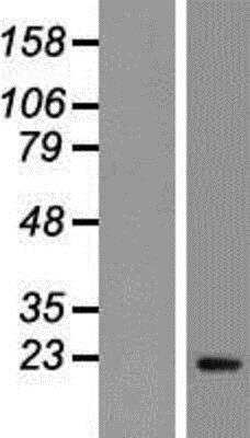 Western Blot: PTTG1 Overexpression Lysate [NBP2-07897]