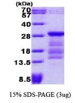 SDS-PAGE: Recombinant Human PTTG1 His Protein [NBP1-30200]