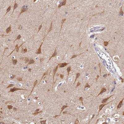 Immunohistochemistry-Paraffin: Seipin/BSCL2 Antibody [NBP1-81812]