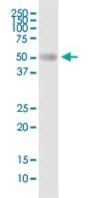 Western Blot: Seipin/BSCL2 Antibody [H00026580-D01P]