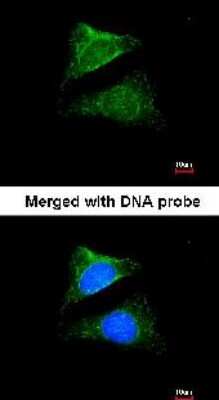 Immunocytochemistry/ Immunofluorescence: Seladin 1 Antibody [NBP1-32247]