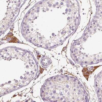 Immunohistochemistry: Seladin 1 Antibody [NBP2-68594]