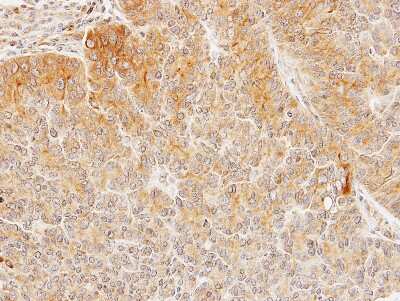 Immunohistochemistry-Paraffin: Seladin 1 Antibody [NBP1-32247]