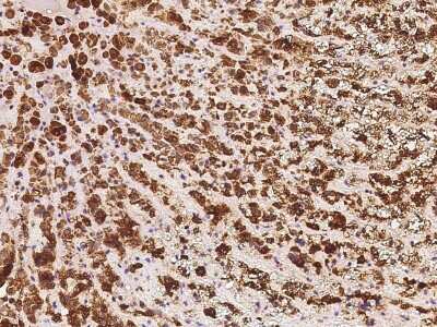 Immunohistochemistry-Paraffin: Seladin 1 Antibody [NBP2-98505]