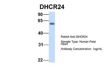 Western Blot: Seladin 1 Antibody [NBP1-59369]