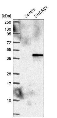 Western Blot: Seladin 1 Antibody [NBP2-38980]