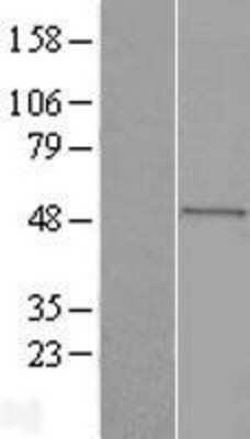 Western Blot: Seladin 1 Overexpression Lysate [NBL1-09857]