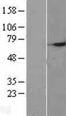 Western Blot: Selenoprotein W Overexpression Lysate [NBP2-10861]