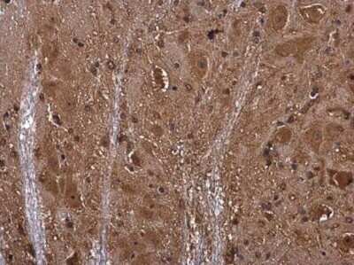 Immunohistochemistry-Paraffin: Semaphorin 3A Antibody [NBP3-12939]