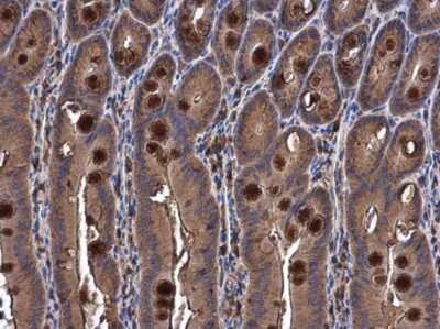 Immunohistochemistry-Paraffin: Semaphorin 3A Antibody [NBP3-12939]