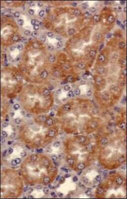 Immunohistochemistry: Semaphorin 3B Antibody [NB100-2218]