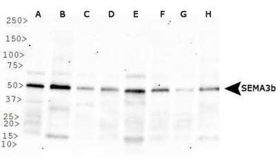 Western Blot: Semaphorin 3B Antibody [NB100-2218]