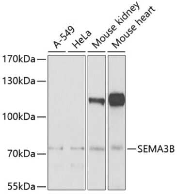 Western Blot: Semaphorin 3B AntibodyBSA Free [NBP2-94522]