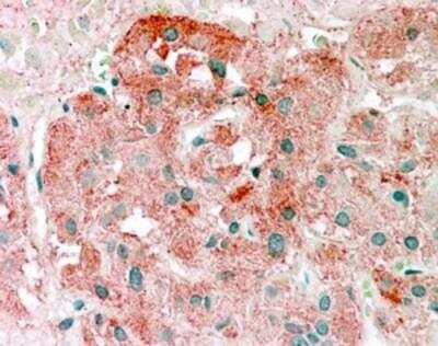 Immunohistochemistry-Paraffin: Semaphorin 3E Antibody [NB100-1433]